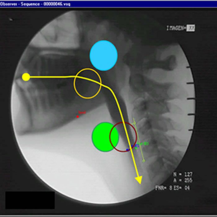 Swallow response